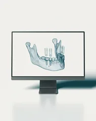 Odontóloga realizando una endodoncia con microscopio en la clínica